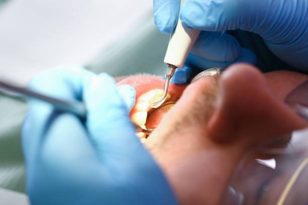 Best 24-Hour Emergency Dentist in Trowbridge Park, MI